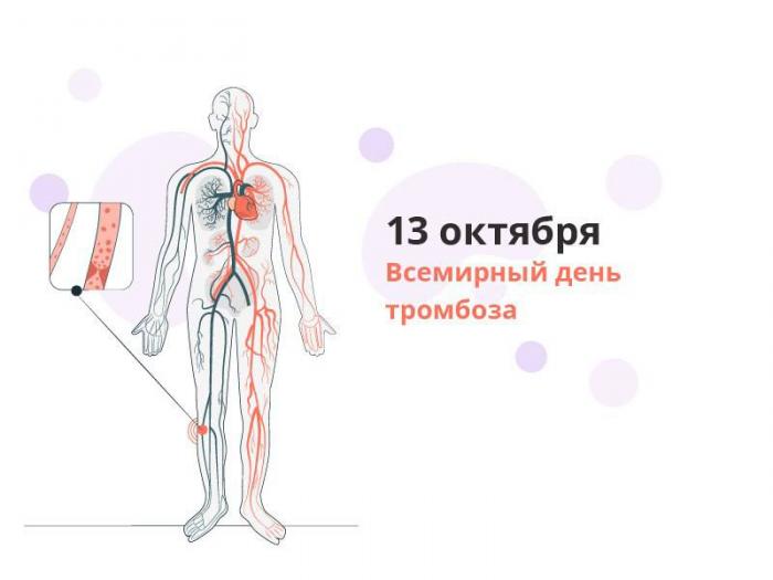 13 октября - Всемирный день тромбоза