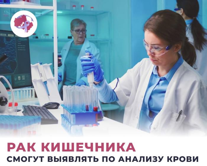 Рак кишечника смогут выявлять по анализу мочи